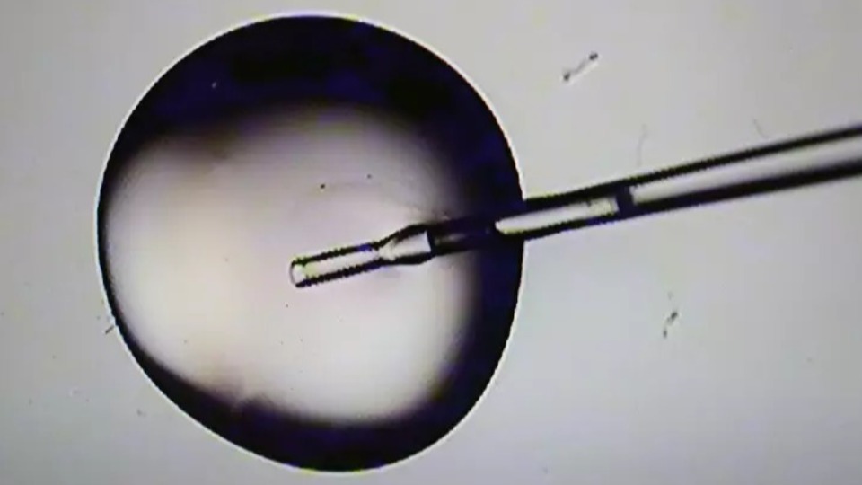Erro em fertilização faz mulher dar à luz a bebê de outra pessoa erro-em-fertilizacao-faz-mulher-dar-a-luz-a-bebe-de-outra-pessoa
