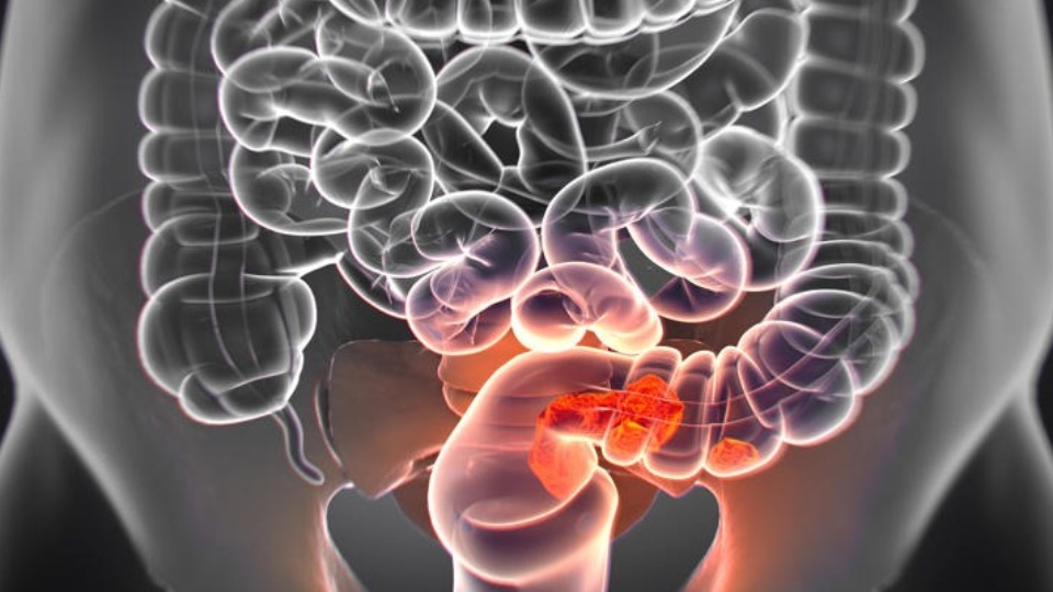 Harvard revela alimento que protege contra o câncer de intestino harvard-revela-alimento-que-protege-contra-o-cancer-de-intestino