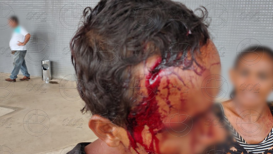 Homem é agredido na rodoviária de Porto Velho e levado ao hospital João Paulo II homem-e-agredido-na-rodoviaria-de-porto-velho-e-levado-ao-hospital-joao-paulo-ii