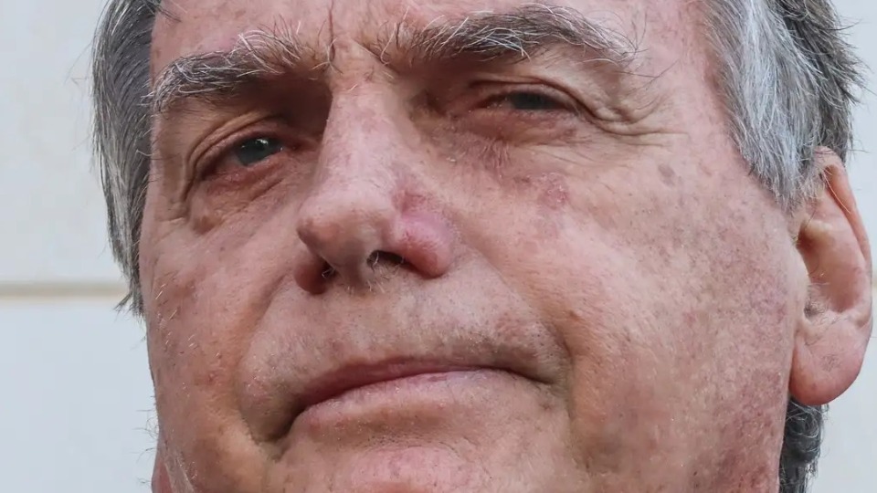 Bolsonaro apresenta piora clínica e vai passar por novos exames bolsonaro-apresenta-piora-clinica-e-vai-passar-por-novos-exames
