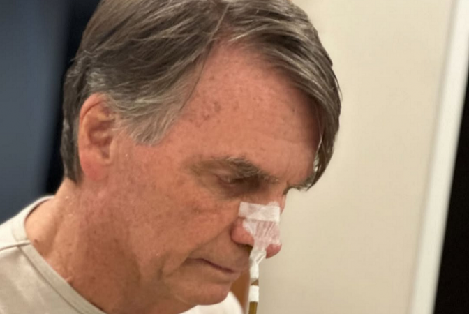 Bolsonaro deixa UTI e tem melhora progressiva dos movimentos intestinais bolsonaro-deixa-uti-e-tem-melhora-progressiva-dos-movimentos-intestinais