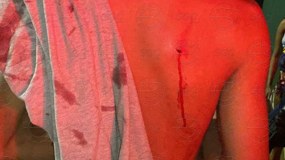 Jovem sofre tentativa de homicídio após discussão na zona Norte jovem-sofre-tentativa-de-homicidio-apos-discussao-na-zona-norte