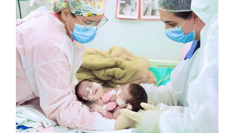 Cirurgia de separação das gêmeas siamesas nascidas no Amazonas é bem-sucedida cirurgia-de-separacao-das-gemeas-siamesas-nascidas-no-amazonas-e-bem-sucedida