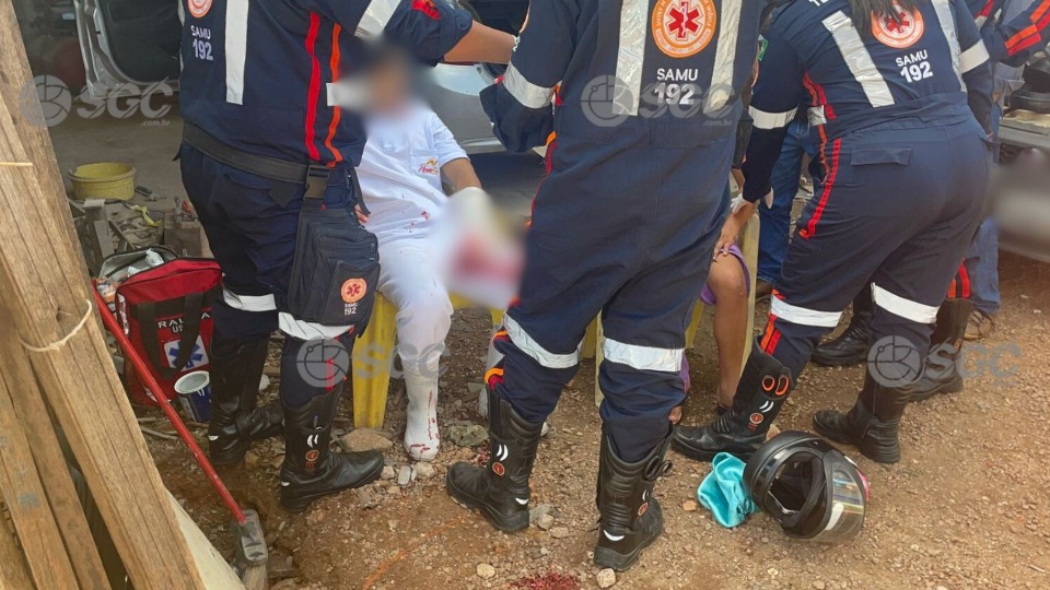 Motociclista sofre fratura exposta após colisão com carro no bairro Nova Porto Velho motociclista-sofre-fratura-exposta-apos-colisao-com-carro-no-bairro-nova-porto-velho