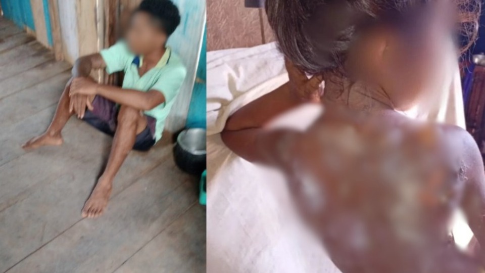 Padrasto é preso suspeito de jogar mingau quente no corpo de criança padrasto-e-preso-suspeito-de-jogar-mingau-quente-no-corpo-de-crianca