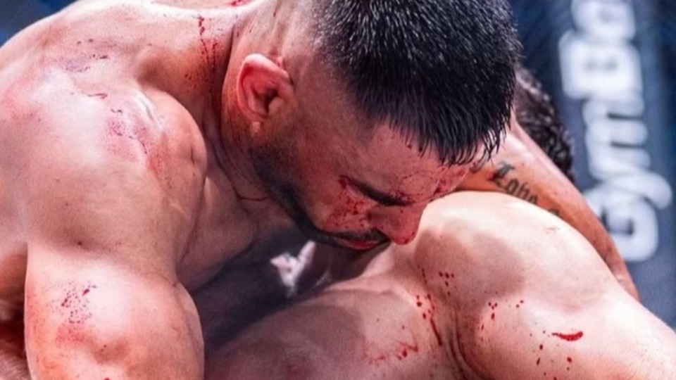 Lutador de MMA desloca mandíbula após vitória lutador-de-mma-desloca-mandibula-apos-vitoria