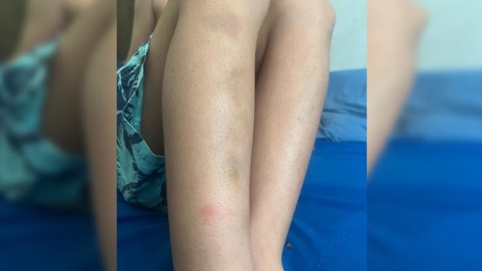 Filho de publicitário preso e agredido por agentes ficou com hematomas filho-de-publicitario-preso-e-agredido-por-agentes-ficou-com-hematomas