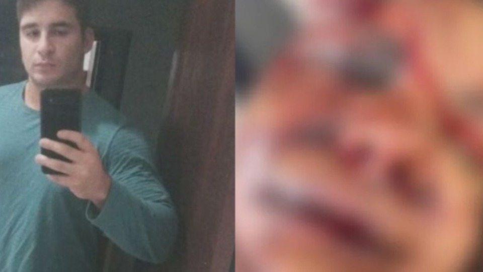 IMAGENS FORTES: mulher agredida pelo namorado fica com rosto desfigurado imagens-fortes:-mulher-agredida-pelo-namorado-fica-com-rosto-desfigurado