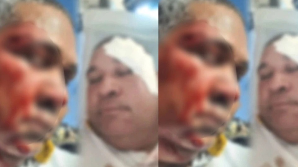 Rodoviário é agredido com martelada na cabeça rodoviario-e-agredido-com-martelada-na-cabeca