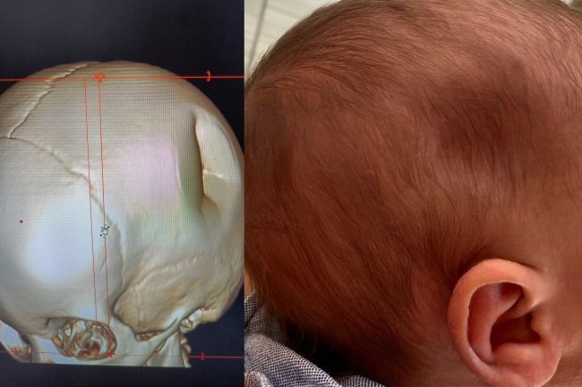 Mãe é presa ao levar bebê com o crânio fraturado para a UPA mae-e-presa-ao-levar-bebe-com-o-cranio-fraturado-para-a-upa