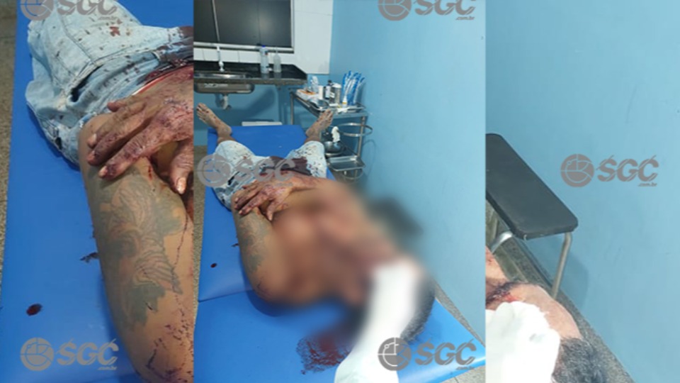 Homem sofre golpe de facão na cabeça durante ataque em homem-sofre-golpe-de-facao-na-cabeca-durante-ataque-em