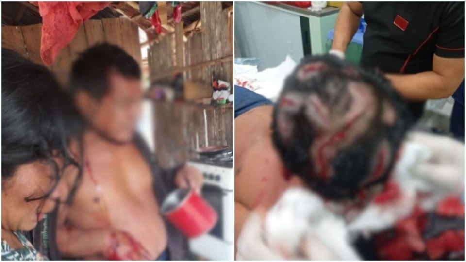 VÍDEO: Homem tem couro cabeludo dilacerado por onça video:-homem-tem-couro-cabeludo-dilacerado-por-onca