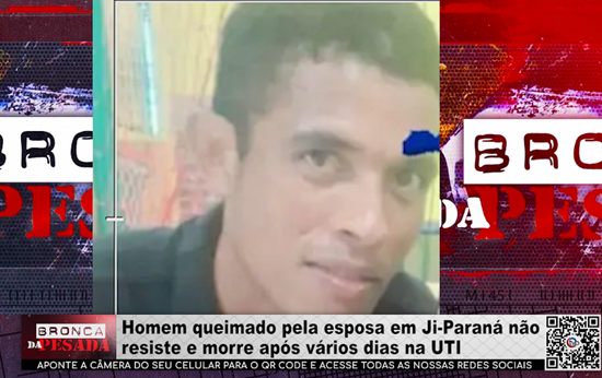 Homem Queimado Pela Esposa em Ji–Paraná Morre Após Dias Internado na UTI homem-queimado-pela-esposa-em-ji–parana-morre-apos-dias-internado-na-uti