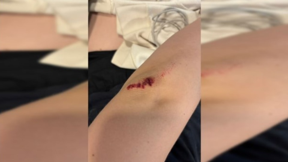 Adolescente se joga de carro de app por medo de ser estuprada adolescente-se-joga-de-carro-de-app-por-medo-de-ser-estuprada
