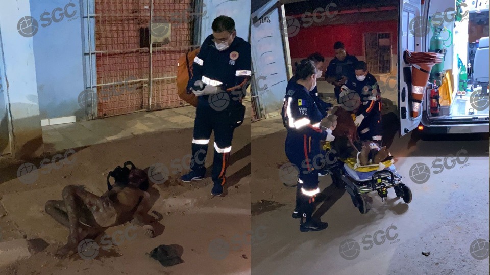 Homem é agredido a pauladas e internado em estado grave no Jardim Santana homem-e-agredido-a-pauladas-e-internado-em-estado-grave-no-jardim-santana
