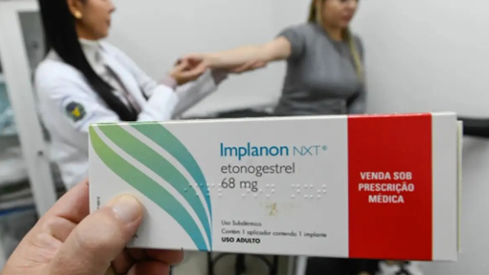 Implante contraceptivo deve ser ofertado por planos a partir de hoje implante-contraceptivo-deve-ser-ofertado-por-planos-a-partir-de-hoje