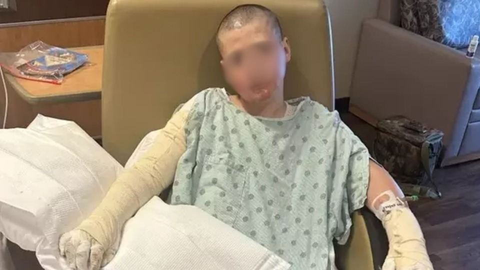 Menino de 12 anos fica internado após se queimar fazendo trend das redes sociais menino-de-12-anos-fica-internado-apos-se-queimar-fazendo-trend-das-redes-sociais
