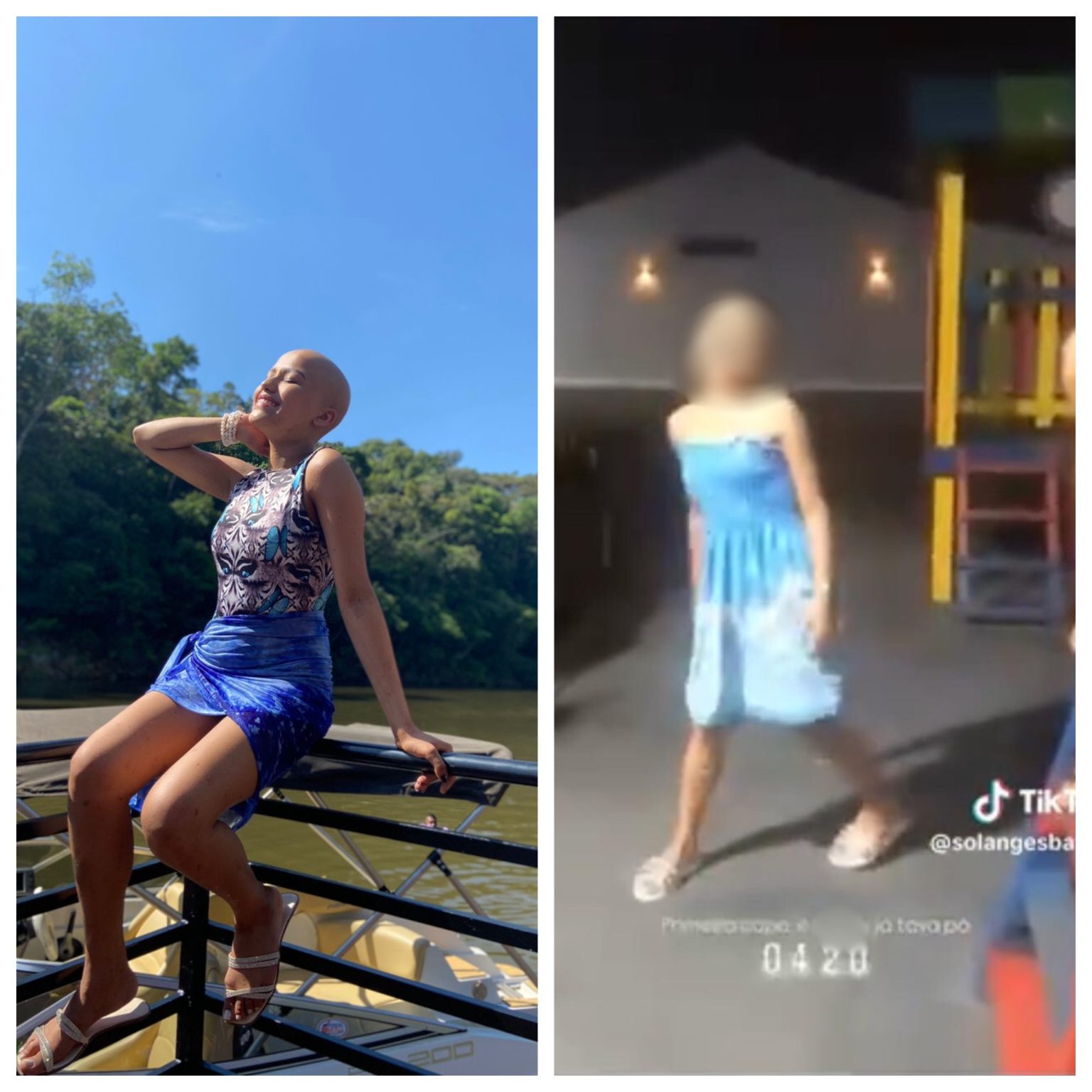 Adolescente com sequelas de câncer é alvo de bullying por colega de escola adolescente-com-sequelas-de-cancer-e-alvo-de-bullying-por-colega-de-escola