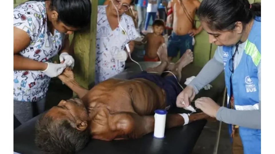 Brasil registra quase 3 mil mortes de Yanomami em 10 anos brasil-registra-quase-3-mil-mortes-de-yanomami-em-10-anos