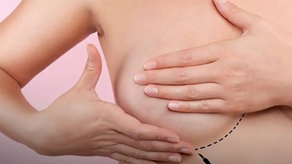 Saúde: Inca estima 73,6 mil novos casos de câncer de mama no Brasil em 2025 saude:-inca-estima-73,6-mil-novos-casos-de-cancer-de-mama-no-brasil-em-2025
