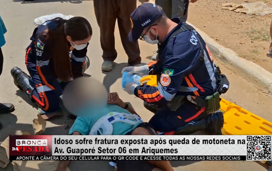 Idoso sofre fratura exposta após queda de motoneta na Av. Guaporé, Setor 06, em Ariquemes idoso-sofre-fratura-exposta-apos-queda-de-motoneta-na-av.-guapore,-setor-06,-em-ariquemes