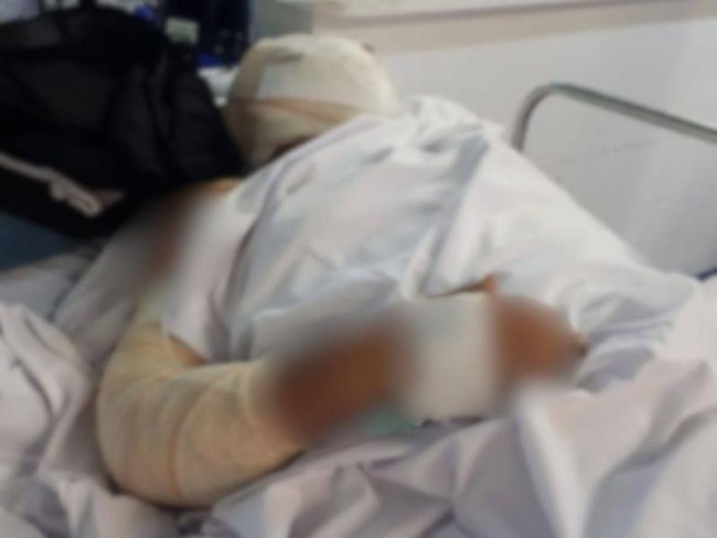 DESESPERO – Homem ateia fogo ao próprio corpo e é intubado em estado grave em Rondônia desespero-–-homem-ateia-fogo-ao-proprio-corpo-e-e-intubado-em-estado-grave-em-rondonia