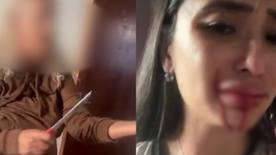 VÍDEO: mãe joga faca no rosto de ex-dançarina do Faustão; vítima sofre corte video:-mae-joga-faca-no-rosto-de-ex-dancarina-do-faustao;-vitima-sofre-corte