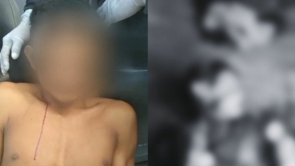 VÍDEO: jovem diz que esquartejou irmãos após ser ameaçado pelo tio video:-jovem-diz-que-esquartejou-irmaos-apos-ser-ameacado-pelo-tio