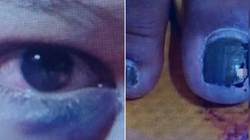 “Vou te cortar toda no facão”: homem ameaçou mulher antes de agredi-la “vou-te-cortar-toda-no-facao”:-homem-ameacou-mulher-antes-de-agredi-la